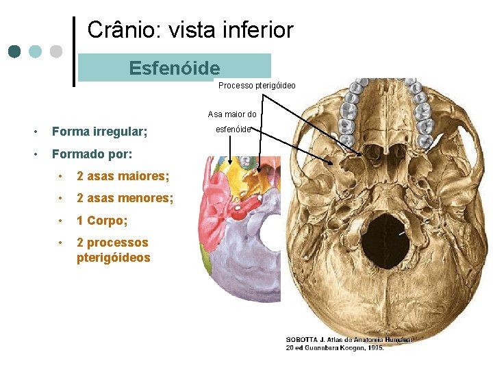 Crânio: vista inferior Esfenóide Processo pterigóideo Asa maior do • Forma irregular; • Formado