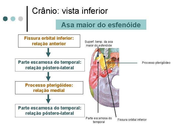 Crânio: vista inferior Asa maior do esfenóide Fissura orbital inferior: relação anterior Superf. temp.