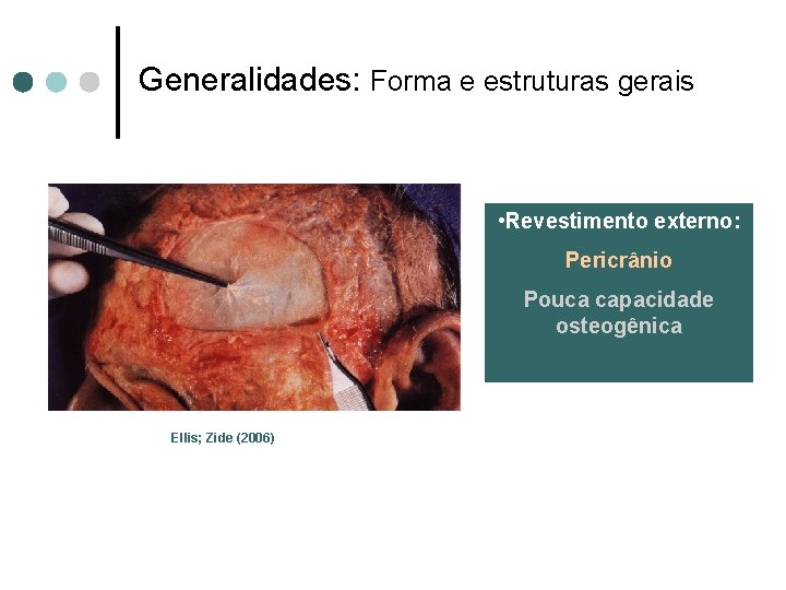 Generalidades: Forma e estruturas gerais • Revestimento externo: Pericrânio Pouca capacidade osteogênica Ellis; Zide