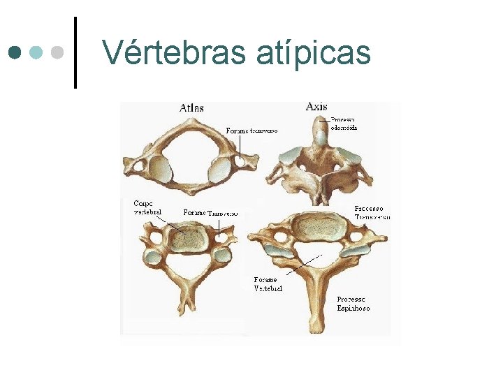 Vértebras atípicas 