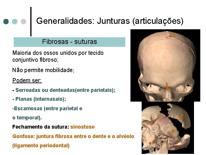 Generalidades: Junturas (articulações) Fibrosas - suturas Maioria dos ossos unidos por tecido conjuntivo fibroso;