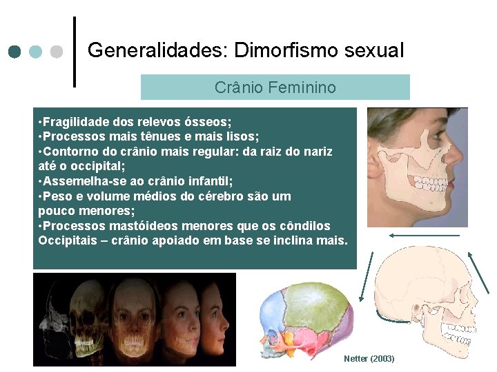 Generalidades: Dimorfismo sexual Crânio Feminino • Fragilidade dos relevos ósseos; • Processos mais tênues