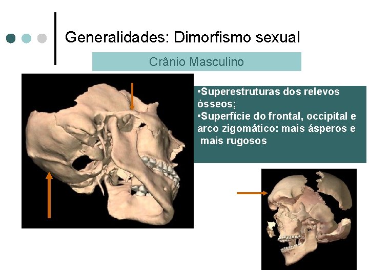 Generalidades: Dimorfismo sexual Crânio Masculino • Superestruturas dos relevos ósseos; • Superfície do frontal,