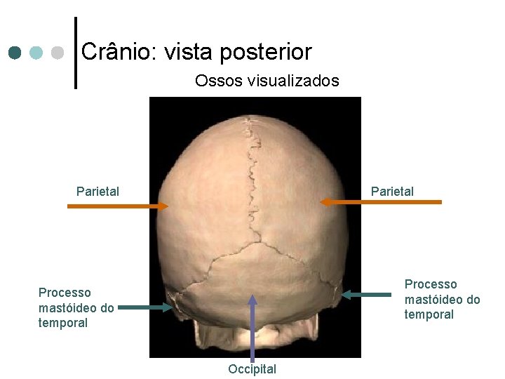 Crânio: vista posterior Ossos visualizados Parietal Processo mastóideo do temporal Occipital 