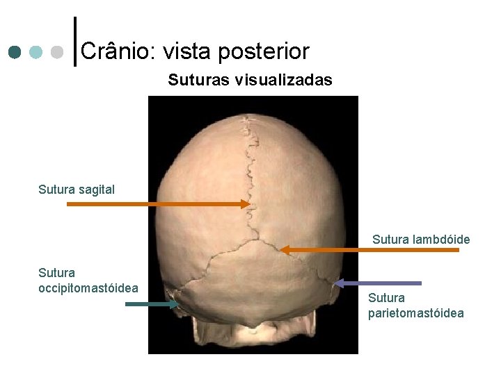 Crânio: vista posterior Suturas visualizadas Sutura sagital Sutura lambdóide Sutura occipitomastóidea Sutura parietomastóidea 