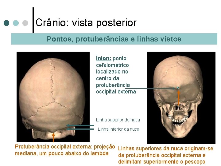 Crânio: vista posterior Pontos, protuberâncias e linhas vistos Ínion: ponto cefalométrico localizado no centro