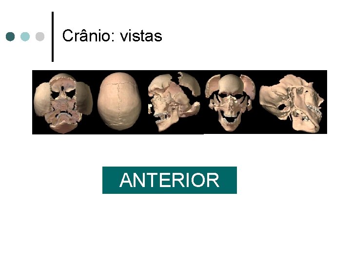 Crânio: vistas ANTERIOR 