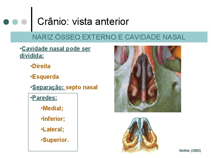 Crânio: vista anterior NARIZ ÓSSEO EXTERNO E CAVIDADE NASAL • Cavidade nasal pode ser