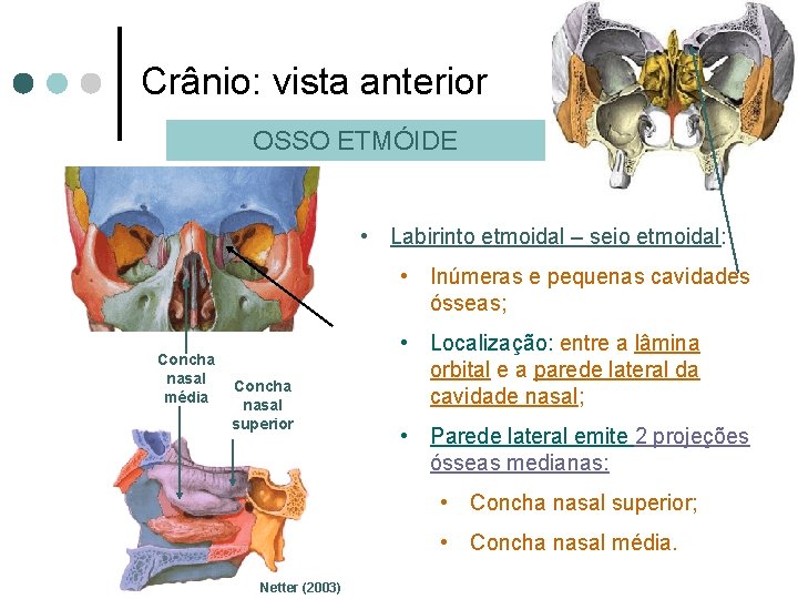 Crânio: vista anterior OSSO ETMÓIDE • Labirinto etmoidal – seio etmoidal: • Inúmeras e