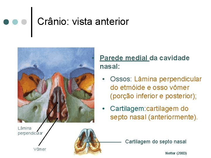 Crânio: vista anterior • Parede medial da cavidade nasal: • Ossos: Lâmina perpendicular do