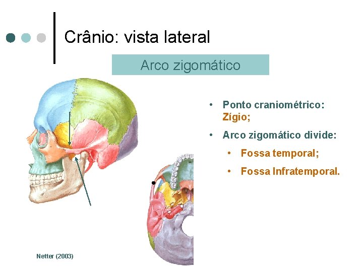 Crânio: vista lateral Arco zigomático • Ponto craniométrico: Zígio; • Arco zigomático divide: •
