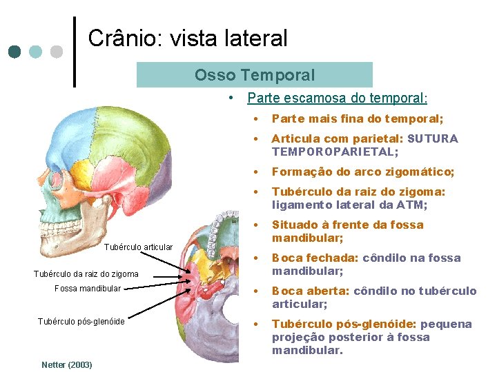 Crânio: vista lateral Osso Temporal • Parte escamosa do temporal: Tubérculo articular • Parte