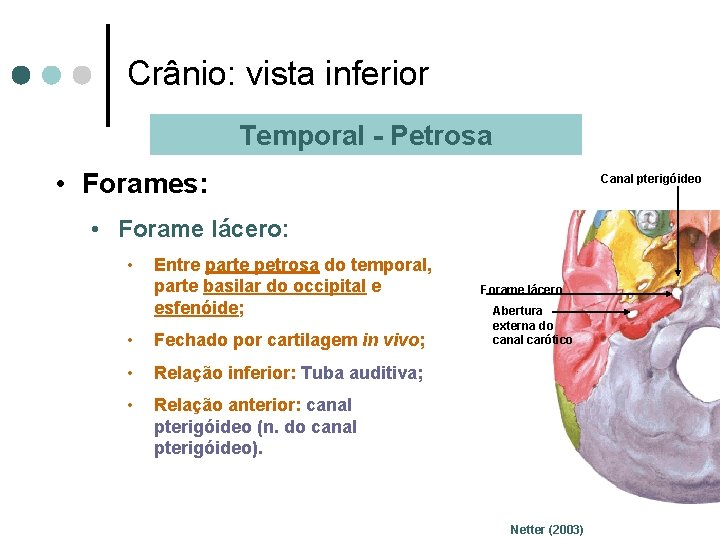 Crânio: vista inferior Temporal - Petrosa • Forames: Canal pterigóideo • Forame lácero: •