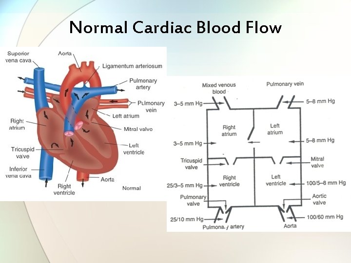 Normal Cardiac Blood Flow 