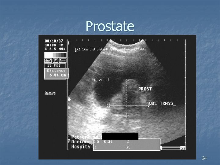 Prostate 24 