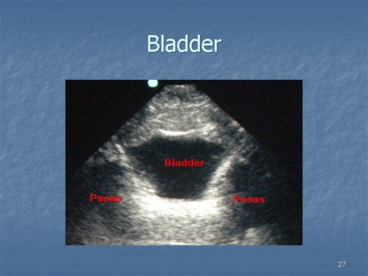 Bladder 27 
