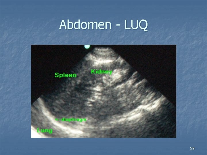 Abdomen - LUQ 29 