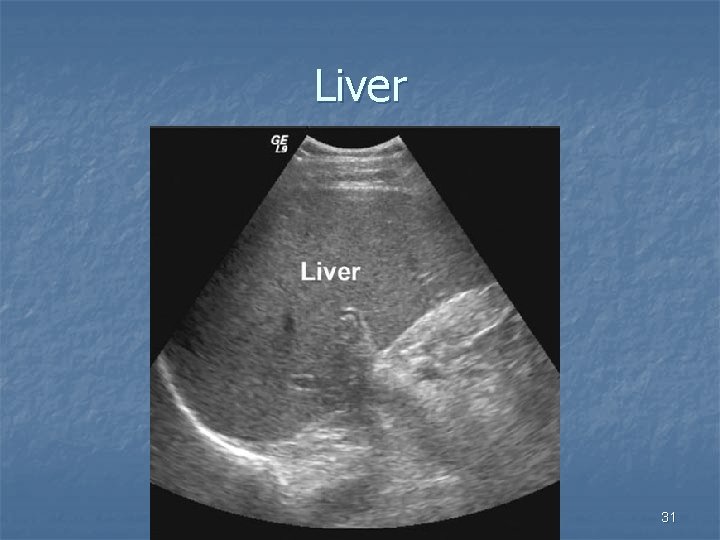 Liver 31 