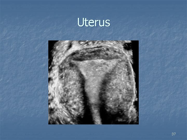 Uterus 37 