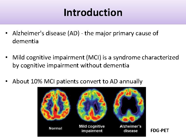 Introduction • Alzheimer's disease (AD) - the major primary cause of dementia • Mild