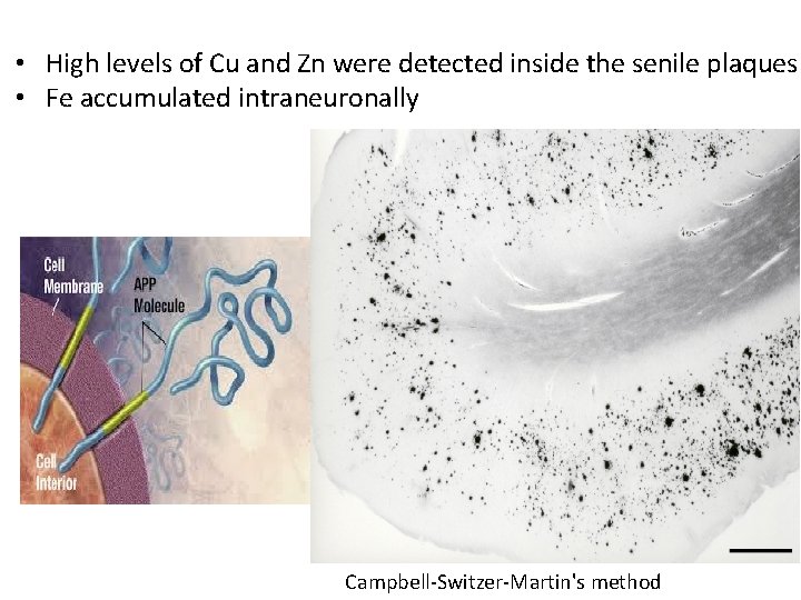  • High levels of Cu and Zn were detected inside the senile plaques
