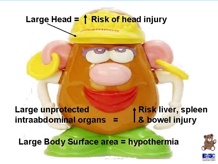 Large Head = Risk of head injury Large unprotected intraabdominal organs = Risk liver,