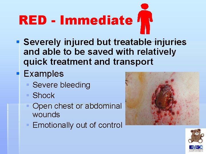 RED - Immediate § Severely injured but treatable injuries and able to be saved