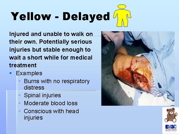Yellow - Delayed Injured and unable to walk on their own. Potentially serious injuries