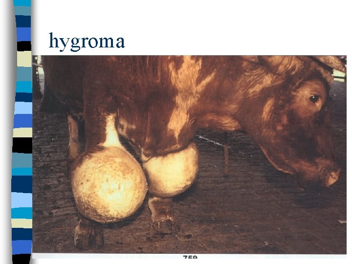 hygroma 