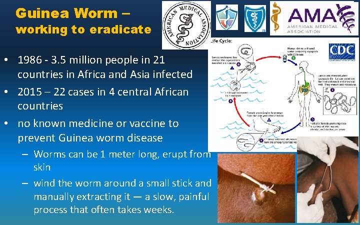 Guinea Worm – working to eradicate • 1986 - 3. 5 million people in