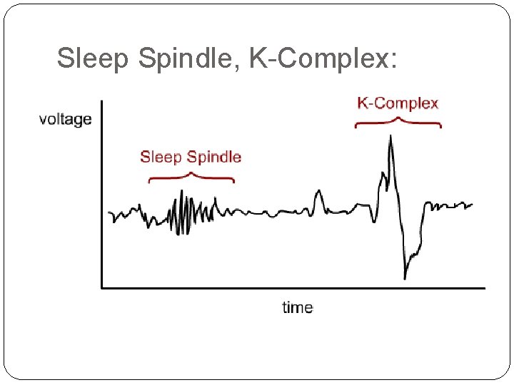 Sleep Spindle, K-Complex: 