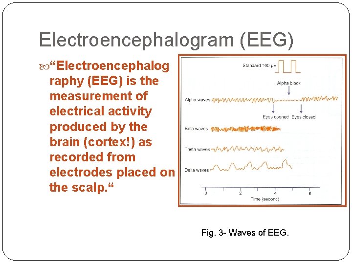 Electroencephalogram (EEG) “Electroencephalog raphy (EEG) is the measurement of electrical activity produced by the