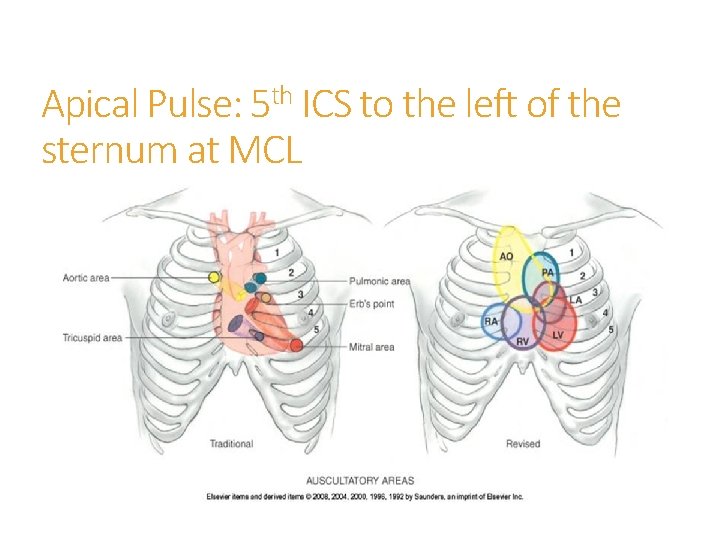 th Apical Pulse: 5 ICS to the left of the sternum at MCL 