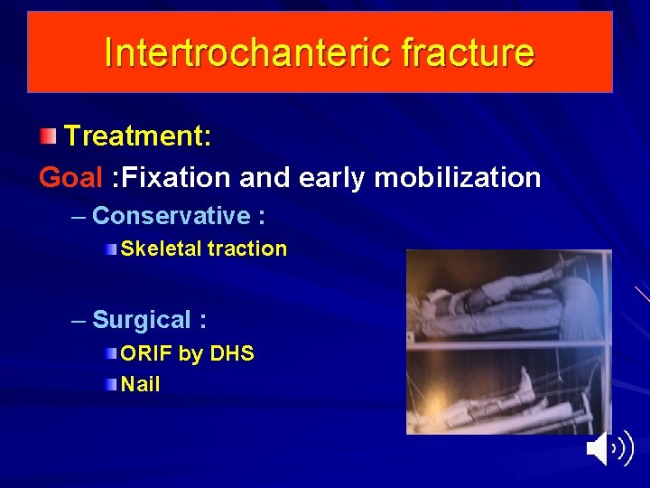 Intertrochanteric fracture Treatment: Goal : Fixation and early mobilization – Conservative : Skeletal traction