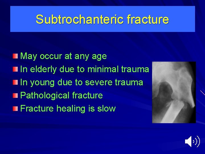 Subtrochanteric fracture May occur at any age In elderly due to minimal trauma In
