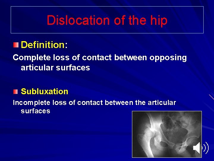 Dislocation of the hip Definition: Complete loss of contact between opposing articular surfaces Subluxation