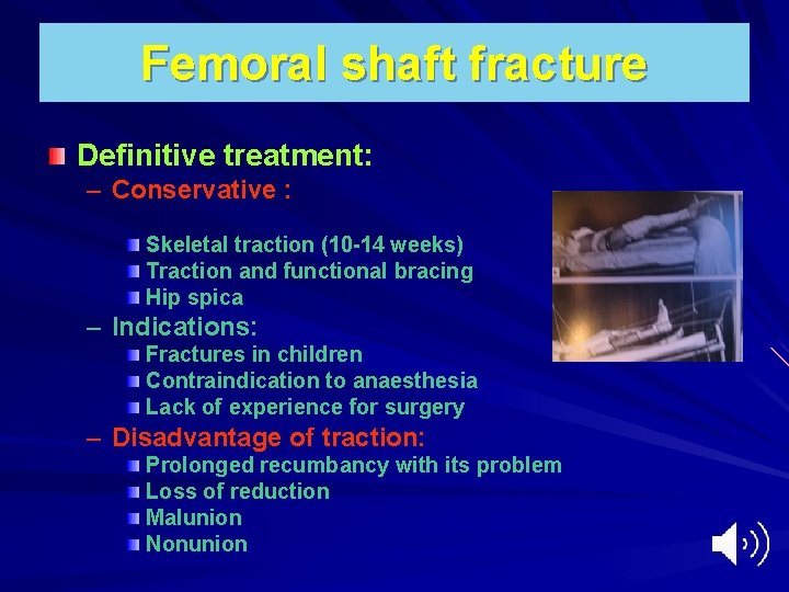 Femoral shaft fracture Definitive treatment: – Conservative : Skeletal traction (10 -14 weeks) Traction