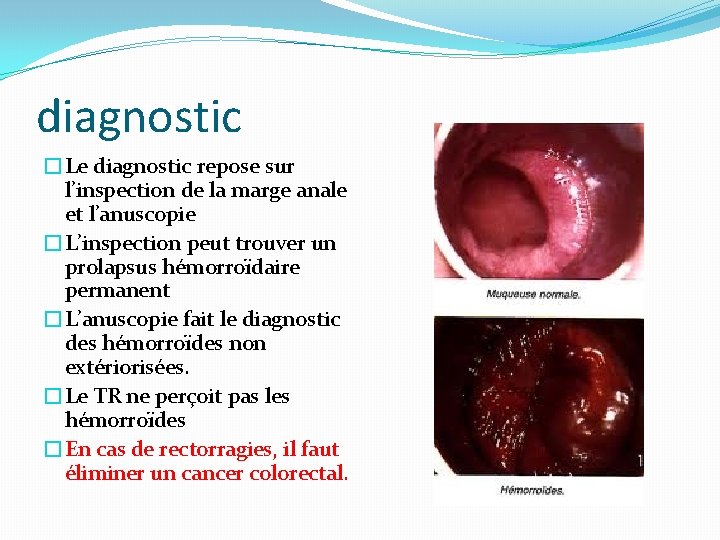 diagnostic �Le diagnostic repose sur l’inspection de la marge anale et l’anuscopie �L’inspection peut