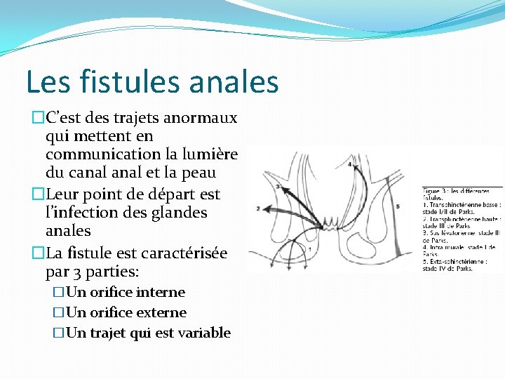 Les fistules anales �C’est des trajets anormaux qui mettent en communication la lumière du