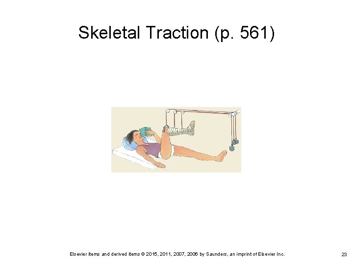 Skeletal Traction (p. 561) Elsevier items and derived items © 2015, 2011, 2007, 2006