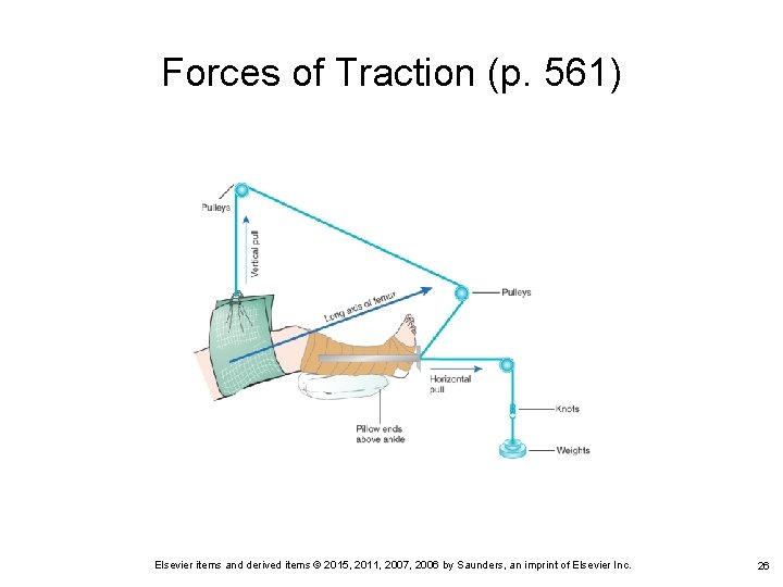 Forces of Traction (p. 561) Elsevier items and derived items © 2015, 2011, 2007,