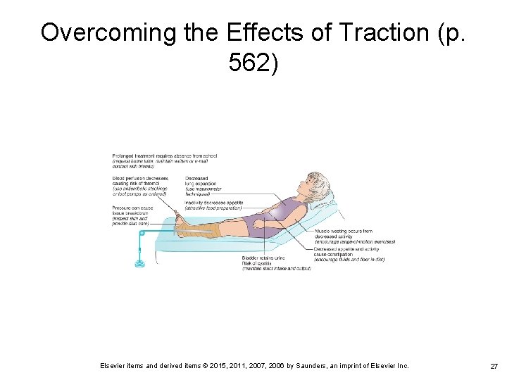 Overcoming the Effects of Traction (p. 562) Elsevier items and derived items © 2015,