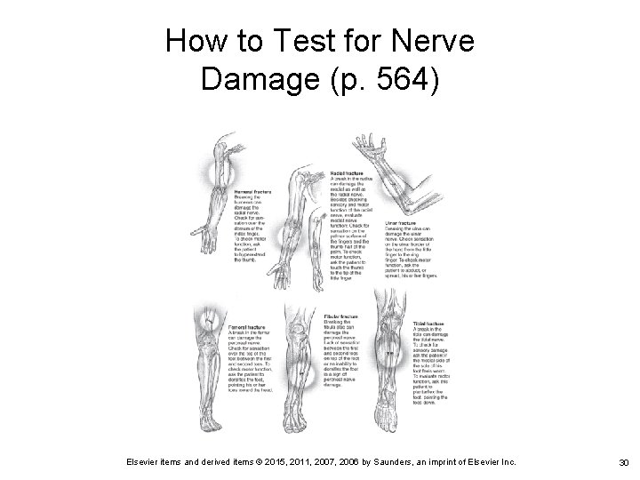 How to Test for Nerve Damage (p. 564) Elsevier items and derived items ©