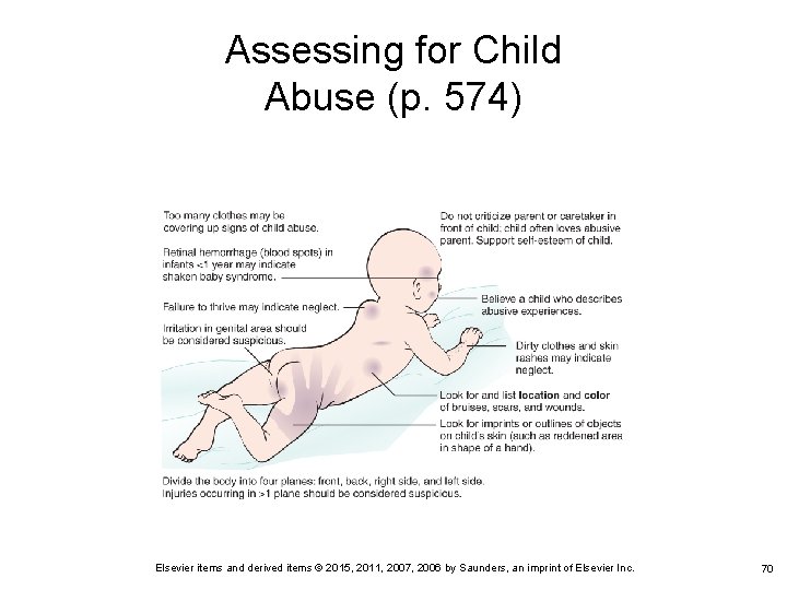 Assessing for Child Abuse (p. 574) Elsevier items and derived items © 2015, 2011,