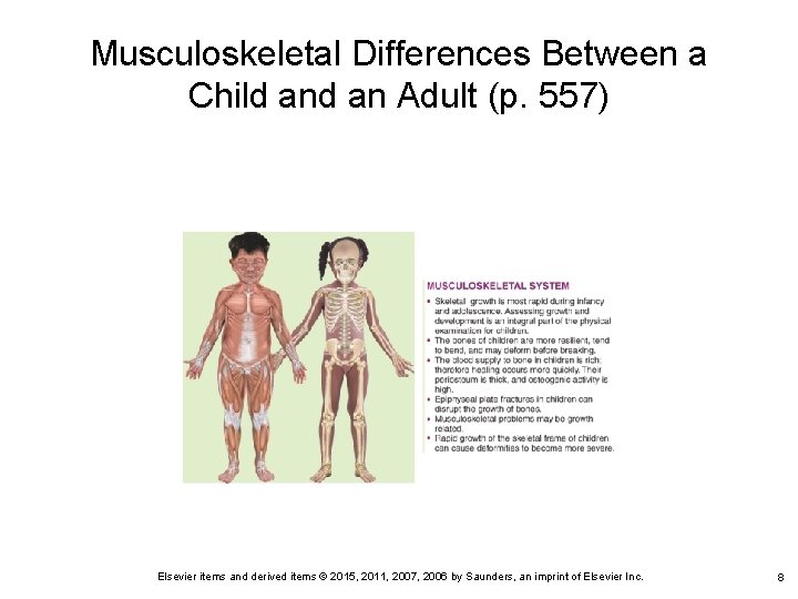 Musculoskeletal Differences Between a Child an Adult (p. 557) Elsevier items and derived items