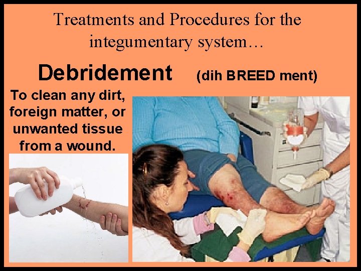 Treatments and Procedures for the integumentary system… Debridement To clean any dirt, foreign matter,