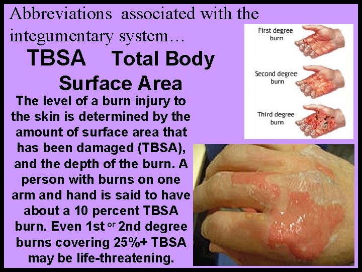 Abbreviations associated with the integumentary system… TBSA Total Body Surface Area The level of