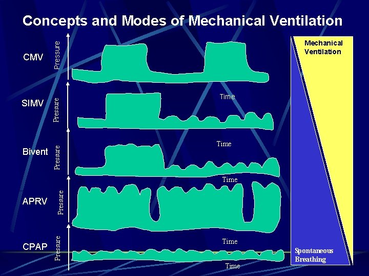 Concepts and Modes of Mechanical Ventilation Bivent Pressure SIMV Pressure CMV Mechanical Ventilation Time