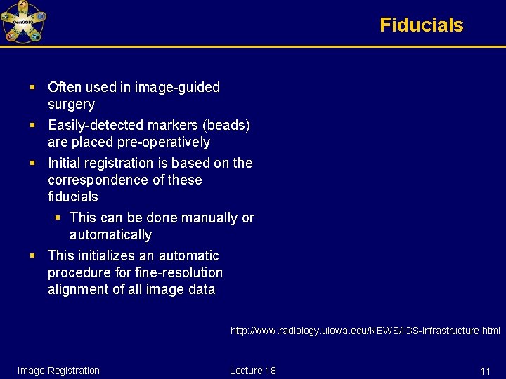 Fiducials § Often used in image-guided surgery § Easily-detected markers (beads) are placed pre-operatively