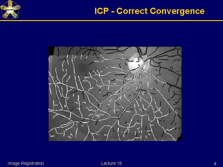 ICP - Correct Convergence Image Registration Lecture 18 4 